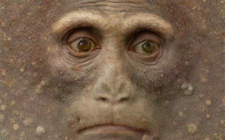 What is Monkeypox – Symptoms and Prevention Methods.